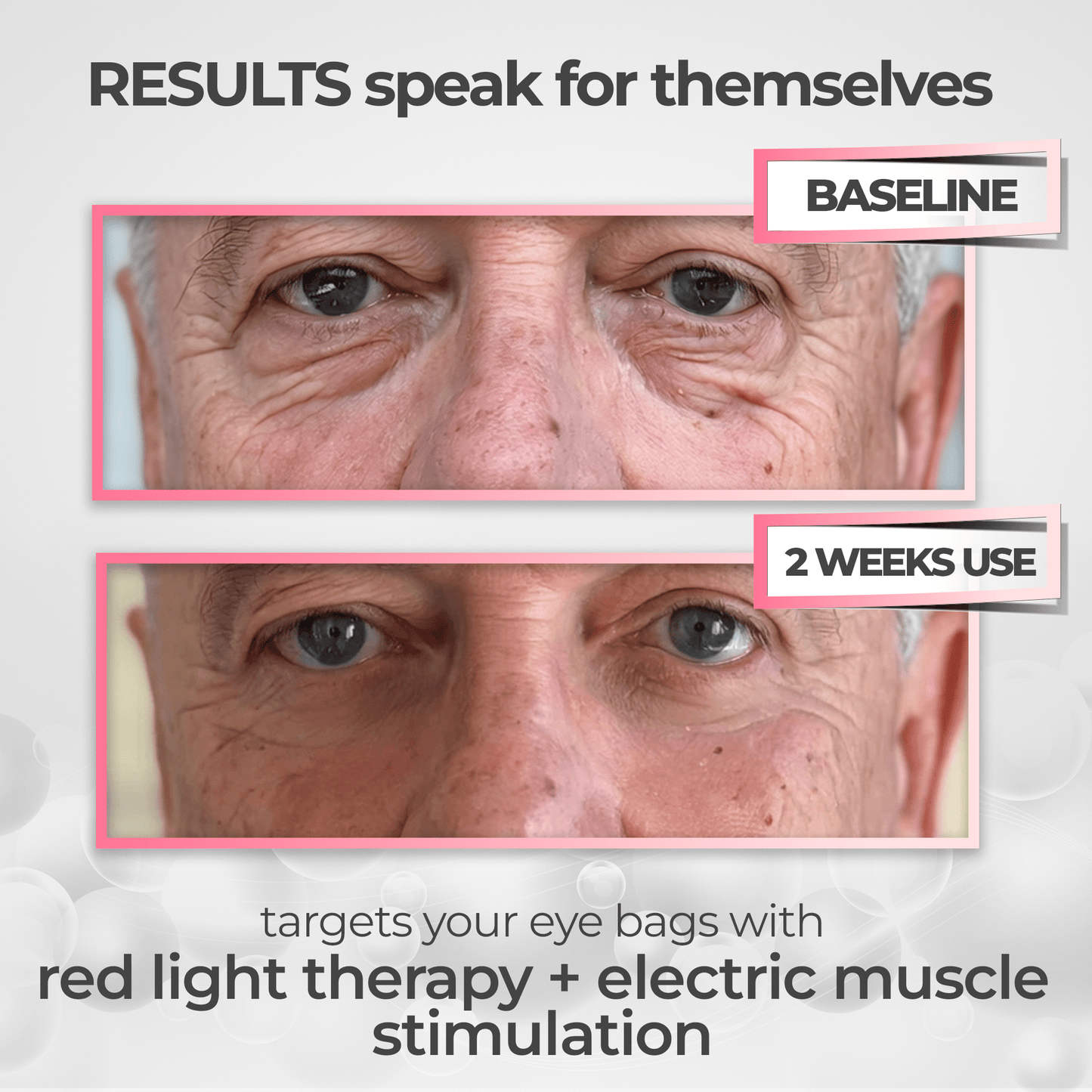 RevitalEyes® 2-in-1 Red Light Therapy + EMS To Erase Eye Bags for Men